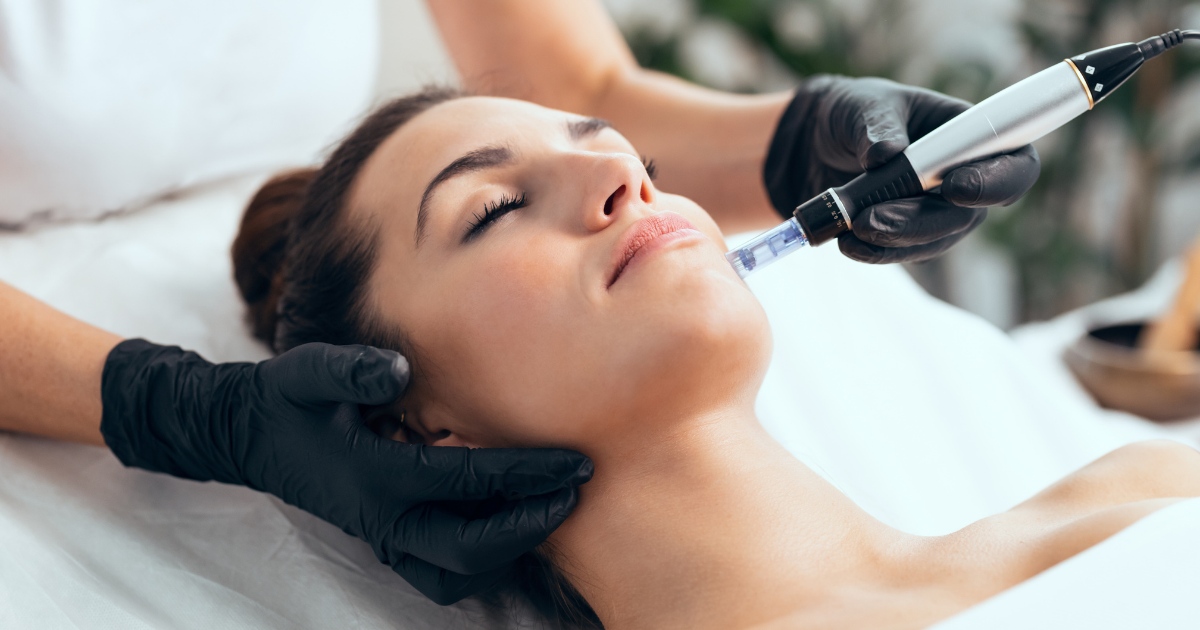 someone getting microneedling