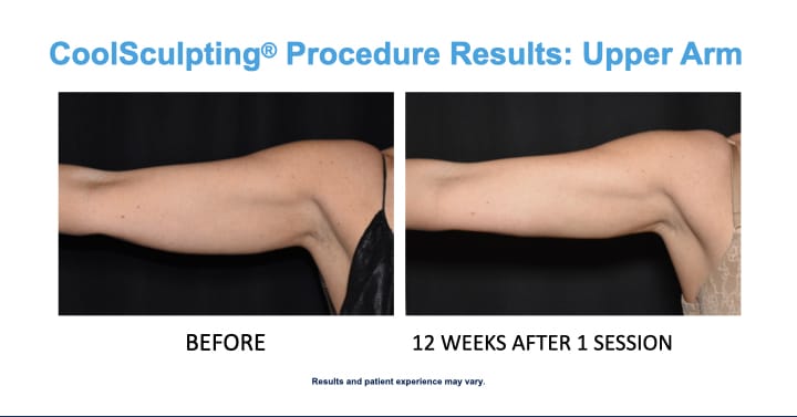 CS Arms Results in Woman