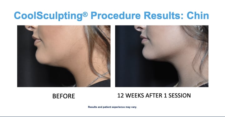 CS Chin results Youngest Woman